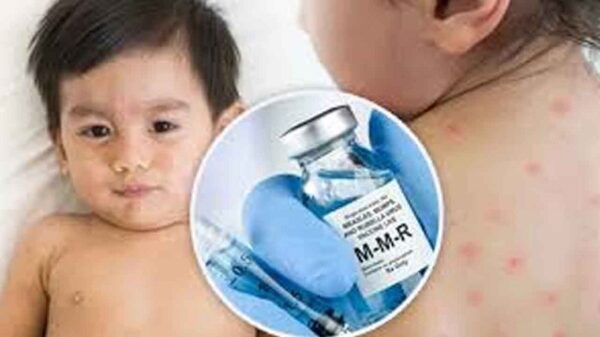 যেসব শিশুকে হামের টিকা না দেওয়ার পরামর্শ দিল মন্ত্রণালয়