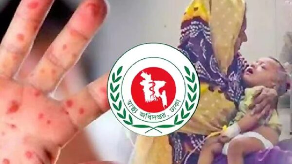 হামে আরও ৬ শিশুর মৃত্যু, আক্রান্ত ১৪৪৫ জন